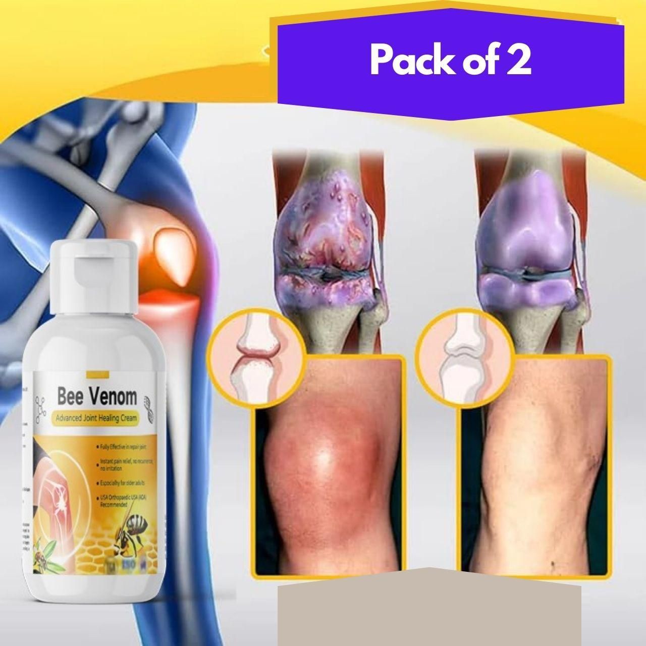 This clinically formulated joint healing cream harnesses the therapeutic properties of bee venom to target inflammation and alleviate joint discomfort. Each value pack includes two 400-gram containers, ensuring comprehensive treatment longevity. The advanced formula penetrates deep into affected tissues, stimulating blood circulation and promoting cellular repair mechanisms. Particularly effective for chronic joint conditions, sports injuries, and age-related joint deterioration.