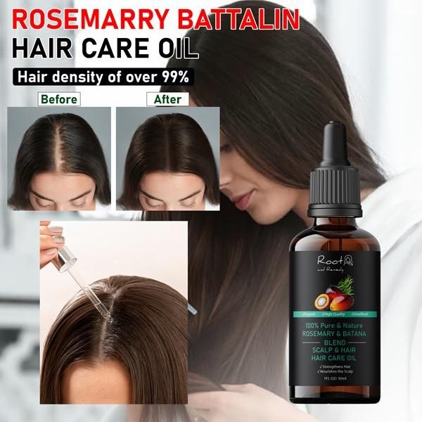 This 30ML blend combines pure Batana oil, prized for its deep moisturizing capabilities, with therapeutic Rosemary oil known for its stimulating properties. Formulated without additives, this potent combination delivers exceptional nourishment for hair follicles while promoting scalp health. The synergistic interaction between these two botanical extracts provides optimal absorption and efficacy for those seeking professional-grade natural solutions.