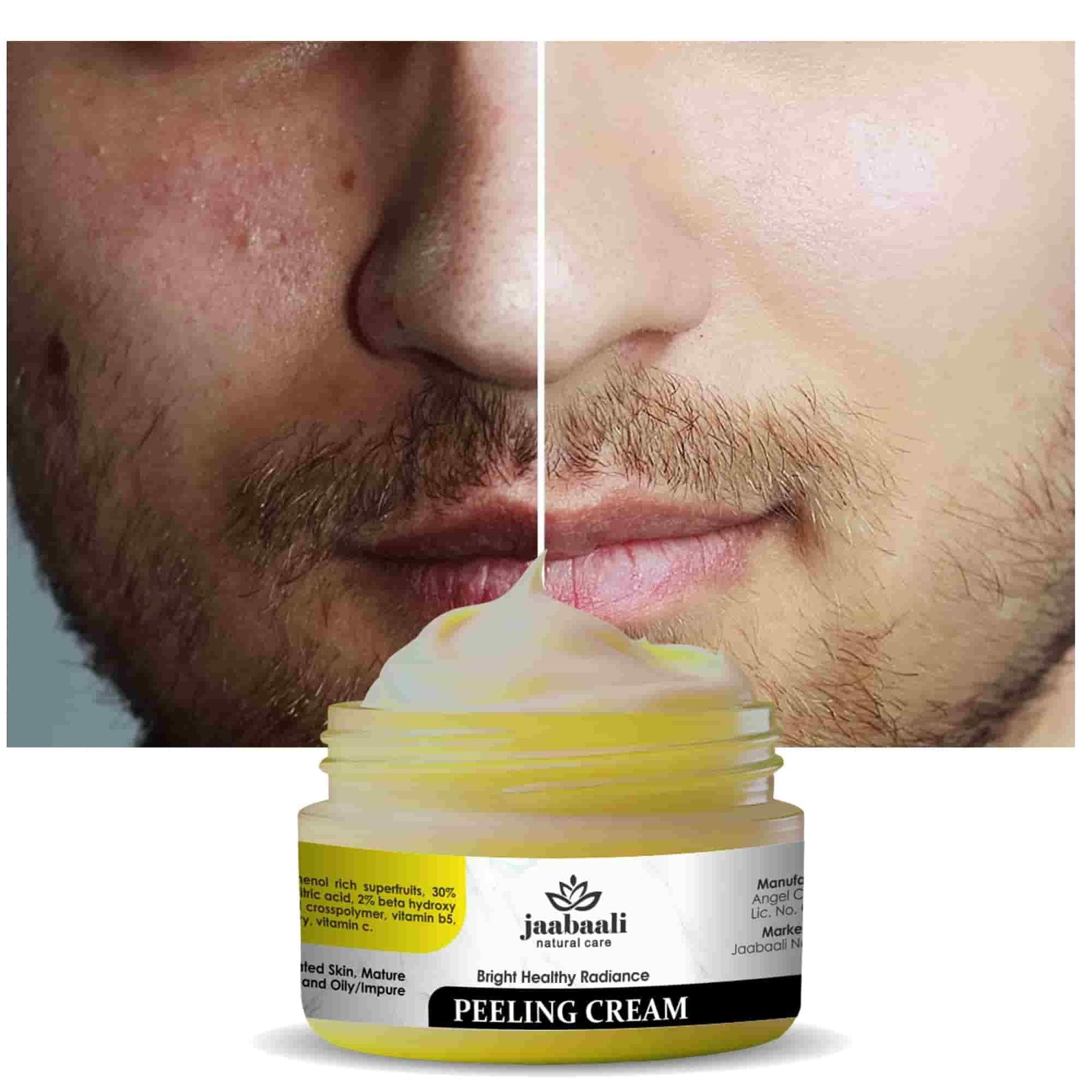 This professional-grade Bright Healthy Radiance Peeling Cream (90gm) utilizes specialized exfoliating compounds to gently dissolve surface impurities and stimulate cellular turnover. The concentrated formula works to visibly improve skin clarity, minimize hyperpigmentation, and enhance overall luminosity. Clinical studies indicate improved skin texture and tone with consistent application, making it an essential component in advanced skincare regimens.