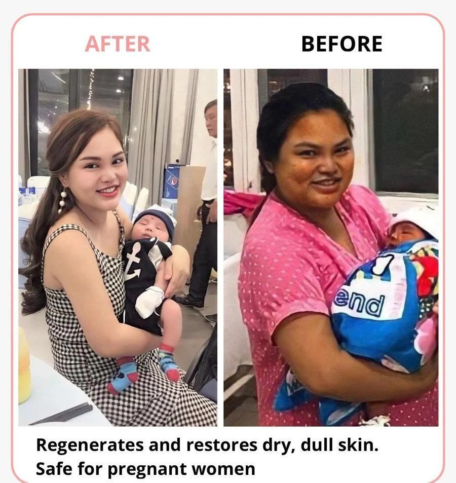 Our advanced Body Wash Whitening Cream combines cleansing and brightening properties in one formula. Developed with dermatologically-tested ingredients, it effectively removes impurities while promoting an even skin tone. Regular use helps diminish dullness and reveals naturally radiant skin without harsh chemicals. Suitable for daily use on all skin types.