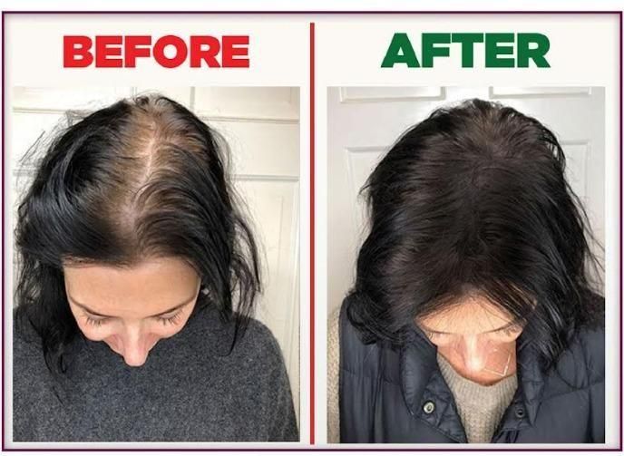 Engineered with advanced German technology, the Ayurved 2-in-1 Instant Hair Color Spray combines traditional Ayurvedic principles with modern color science. This dual-action formula provides immediate gray coverage while nourishing hair follicles. The convenient pack of two ensures extended use, delivering professional-quality results without ammonia or harsh chemicals. Ideal for maintaining color between treatments with minimal application time.