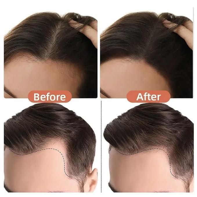 The Natural Hair Shading Sponge Pen combines precision application with professional-grade blending capabilities. Engineered with a specialized sponge applicator that distributes product evenly while maintaining control over placement and intensity. Particularly effective for creating dimensional color transitions, concealing sparse areas, and achieving natural-looking hair enhancement without visible demarcation lines.