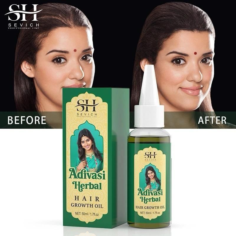 SH Adivasi Hernal Hair Growth Oil harnesses indigenous botanical knowledge to address hair loss concerns effectively. This concentrated 60ml formulation delivers essential nutrients directly to hair follicles, stimulating dormant roots and enhancing cellular regeneration. The dual-pack system ensures a complete treatment cycle, allowing for consistent application that progressively strengthens hair structure, reduces premature shedding, and promotes visibly thicker growth patterns with continued use.