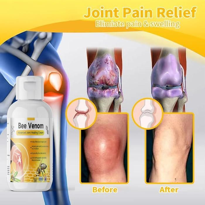 This clinically formulated joint healing cream harnesses the therapeutic properties of bee venom to target inflammation and alleviate joint discomfort. Each value pack includes two 400-gram containers, ensuring comprehensive treatment longevity. The advanced formula penetrates deep into affected tissues, stimulating blood circulation and promoting cellular repair mechanisms. Particularly effective for chronic joint conditions, sports injuries, and age-related joint deterioration.