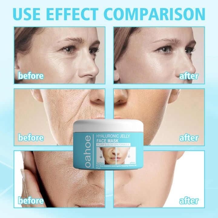 Revitalize your skin with our Hyaluronic Jelly Face Mask, formulated with hyaluronic acid to combat signs of aging. This professional-grade gel mask delivers intense hydration while promoting elasticity and firmness. Each 50g container provides optimal moisture retention and dermal rejuvenation. Convenient pack of two ensures consistent treatment for maintaining youthful, radiant skin.