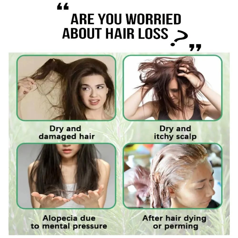 This clinically-developed Anti Hair Loss Care oil delivers targeted follicular nourishment to combat thinning hair. The dual-action formula strengthens the scalp's microbiome while stimulating cellular regeneration for accelerated growth. Each pack provides two 30ml bottles of concentrated treatment, sufficient for a complete therapeutic cycle. Regular application helps normalize sebum production, reduce DHT buildup, and reinforce hair structure from root to tip, resulting in measurably denser, more resilie