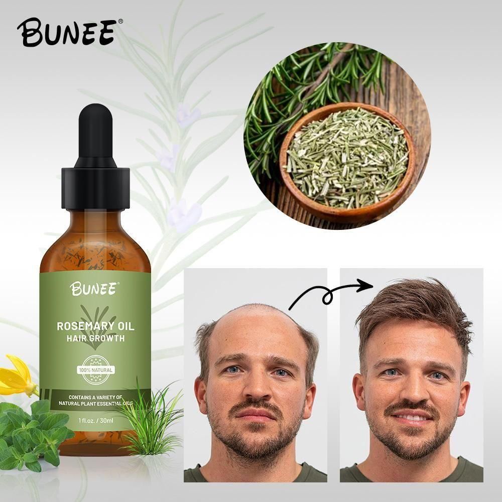 BUNEE Rosemary Hair Growth Serum Oil harnesses the scientifically-backed properties of rosemary to stimulate follicular activity and enhance microcirculation in the scalp. This professional-grade 30 ML formulation delivers targeted nutrients to hair roots, addressing thinning concerns while strengthening the hair shaft structure. Available in dual or triple packs for optimal treatment continuity and sustained results over time.