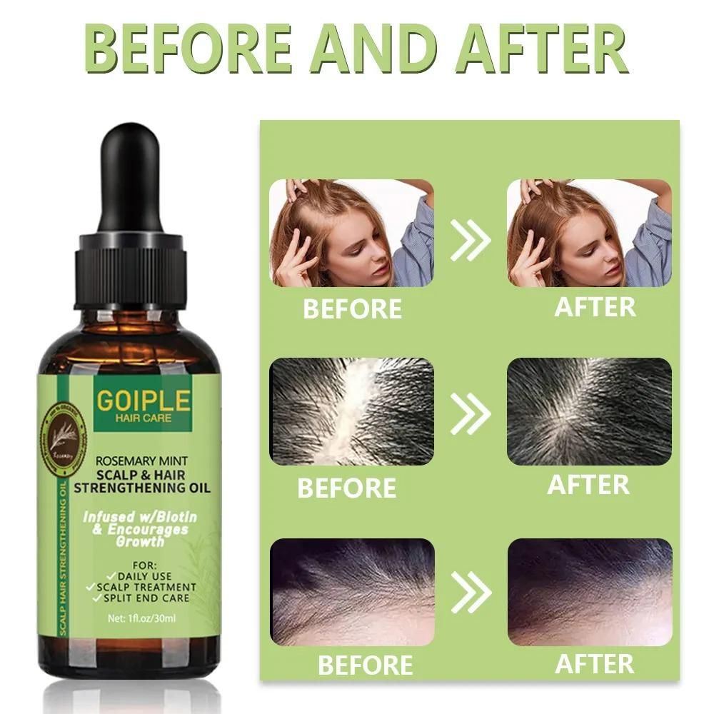 This clinically-developed Anti Hair Loss Care oil delivers targeted follicular nourishment to combat thinning hair. The dual-action formula strengthens the scalp's microbiome while stimulating cellular regeneration for accelerated growth. Each pack provides two 30ml bottles of concentrated treatment, sufficient for a complete therapeutic cycle. Regular application helps normalize sebum production, reduce DHT buildup, and reinforce hair structure from root to tip, resulting in measurably denser, more resilie