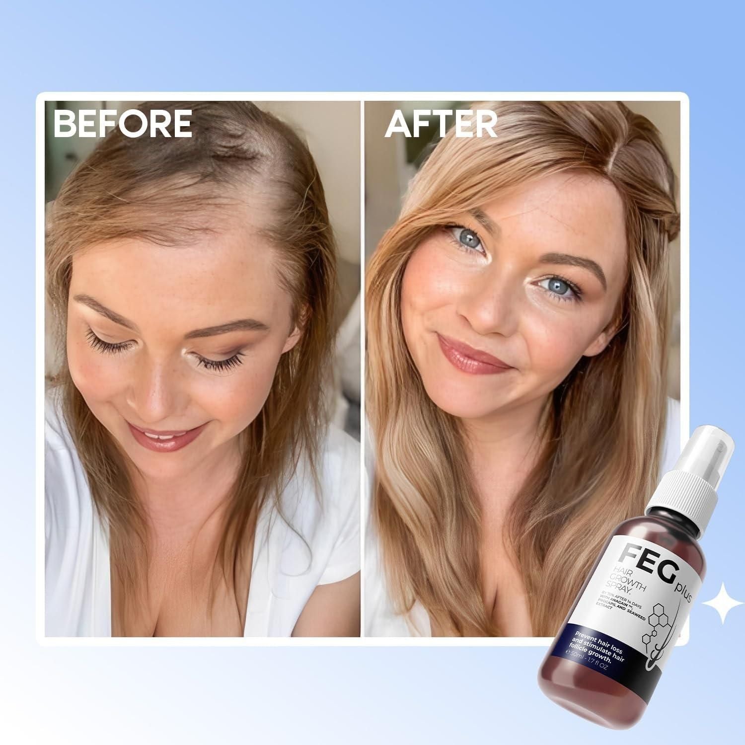 EFGPLUS Hair Growth Spray delivers concentrated follicular nourishment in a precise 50ml formula. This specialized solution utilizes advanced compounds to stimulate dormant hair follicles, enhance microcirculation, and strengthen the hair shaft from root to tip. Clinically developed to address pattern thinning while supporting natural growth cycles for measurably improved density and vitality.