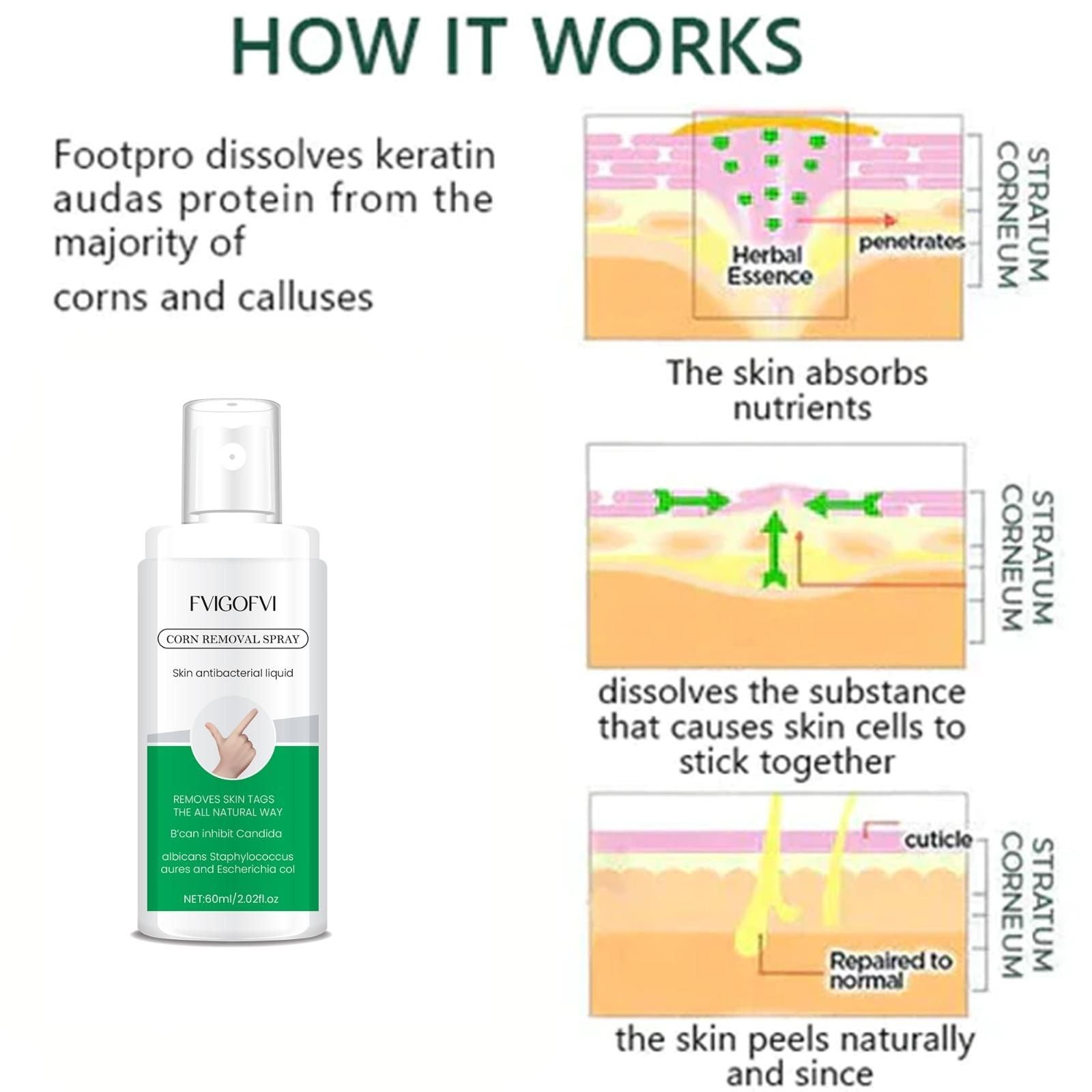 Effectively eliminate painful foot corns with our professional-grade Corn Removal Spray. This convenient pack of two 120ml bottles provides long-lasting treatment for stubborn corns. Formulated with clinically-tested ingredients that penetrate deeply to soften hardened skin and facilitate painless corn removal. Ideal for regular maintenance of foot health and preventing corn recurrence. Each application delivers precise dosage for optimal results.
