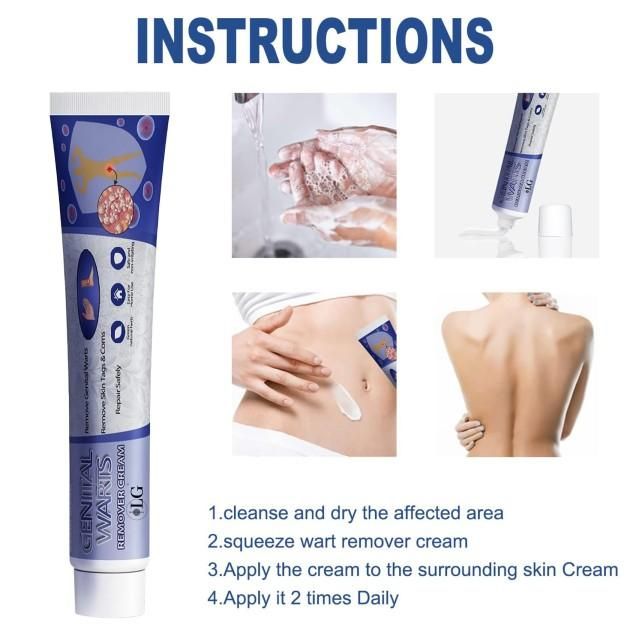 Lucky Glow Genital Warts Remover Cream provides targeted treatment for genital warts with its scientifically formulated composition. This 20gm preparation works by gradually breaking down wart tissue while preserving surrounding healthy skin. The dermatologically tested formula helps reduce visibility and may prevent recurrence when used as directed. For optimal results and safety, consultation with a healthcare provider is recommended prior to beginning treatment to ensure proper diagnosis and application 