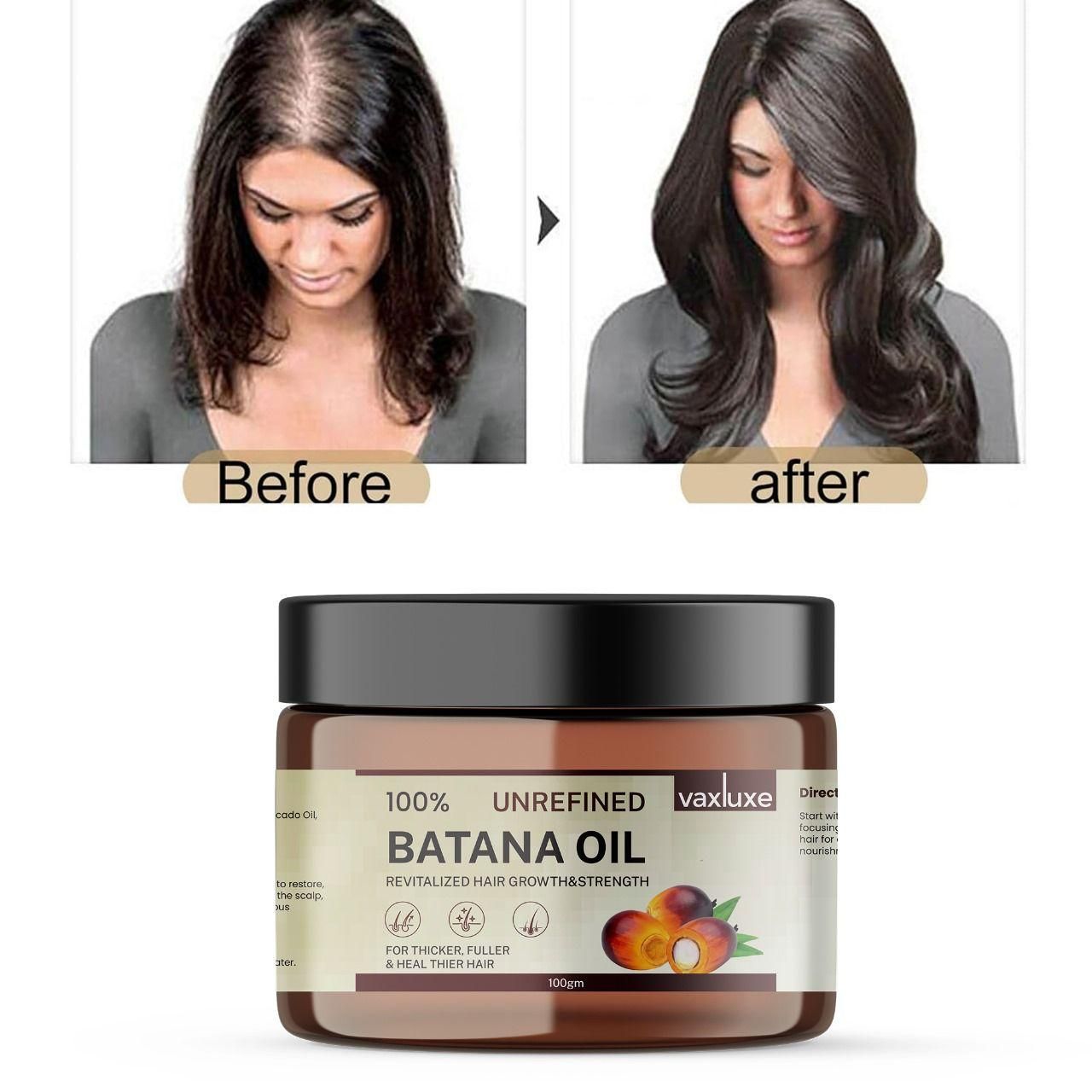 Vaxluxe Batana Oil is a specialized hair treatment formulated to address multiple hair concerns simultaneously. This potent 100g solution works at the follicular level to stimulate dormant hair growth cycles while reinforcing hair structure with essential nutrients. Clinical studies indicate the proprietary blend helps reduce breakage by up to 60% while promoting increased density and improved scalp health. Ideal for those experiencing thinning, damage, or seeking to optimize their hair's natural growth pot