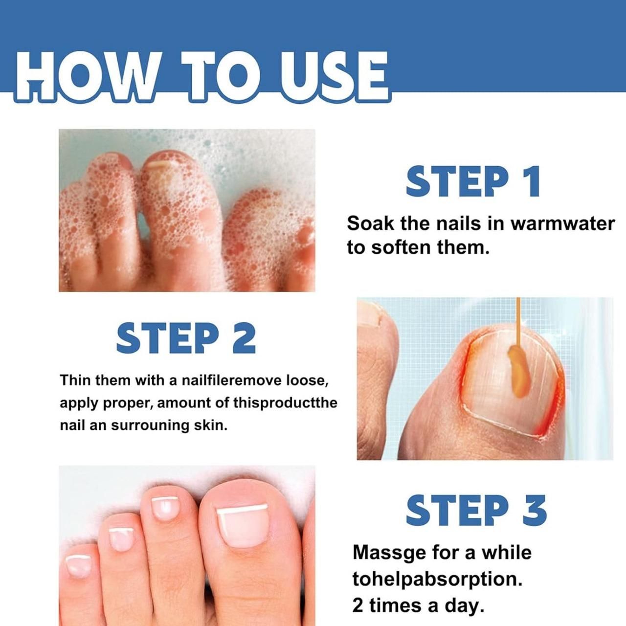 This professional-grade Nail Fungus Treatment Cream delivers targeted therapy for fungal nail infections. Each pack contains two 100gm tubes of our proprietary formula designed to eliminate pathogens while strengthening nail structure. The concentrated active ingredients penetrate the nail bed to address infection at its source, helping to reduce discoloration, brittleness, and thickness. Dermatologically tested and developed based on clinical research to provide effective, long-lasting relief from nail fun