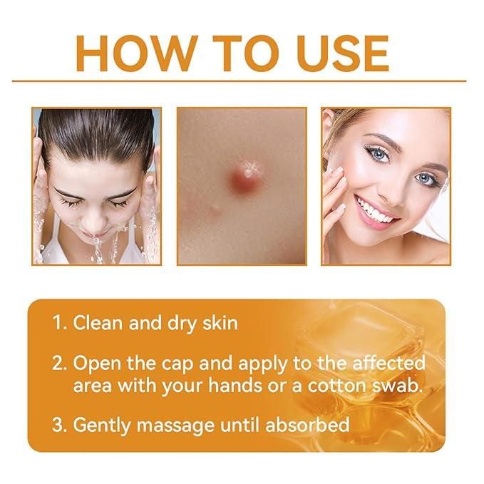 Harness the power of nature's secret with our Bee Venom Skin Treatment Cream. This specialized formulation utilizes apitoxin to stimulate collagen production and improve skin elasticity. Each pack contains two 100g jars, providing a comprehensive skincare regimen that helps reduce the appearance of fine lines while promoting cellular regeneration. Dermatologically tested for optimal efficacy and suitable for daily application on most skin types.