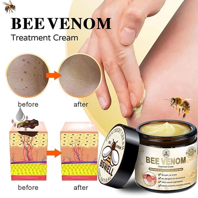 Harness the power of nature's secret with our Bee Venom Skin Treatment Cream. This specialized formulation utilizes apitoxin to stimulate collagen production and improve skin elasticity. Each pack contains two 100g jars, providing a comprehensive skincare regimen that helps reduce the appearance of fine lines while promoting cellular regeneration. Dermatologically tested for optimal efficacy and suitable for daily application on most skin types.
