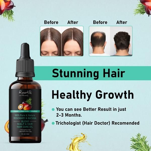 This 30ML blend combines pure Batana oil, prized for its deep moisturizing capabilities, with therapeutic Rosemary oil known for its stimulating properties. Formulated without additives, this potent combination delivers exceptional nourishment for hair follicles while promoting scalp health. The synergistic interaction between these two botanical extracts provides optimal absorption and efficacy for those seeking professional-grade natural solutions.