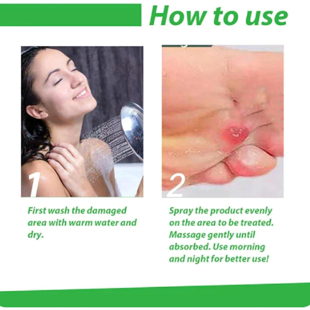 Effectively eliminate painful foot corns with our professional-grade Corn Removal Spray. This convenient pack of two 120ml bottles provides long-lasting treatment for stubborn corns. Formulated with clinically-tested ingredients that penetrate deeply to soften hardened skin and facilitate painless corn removal. Ideal for regular maintenance of foot health and preventing corn recurrence. Each application delivers precise dosage for optimal results.
