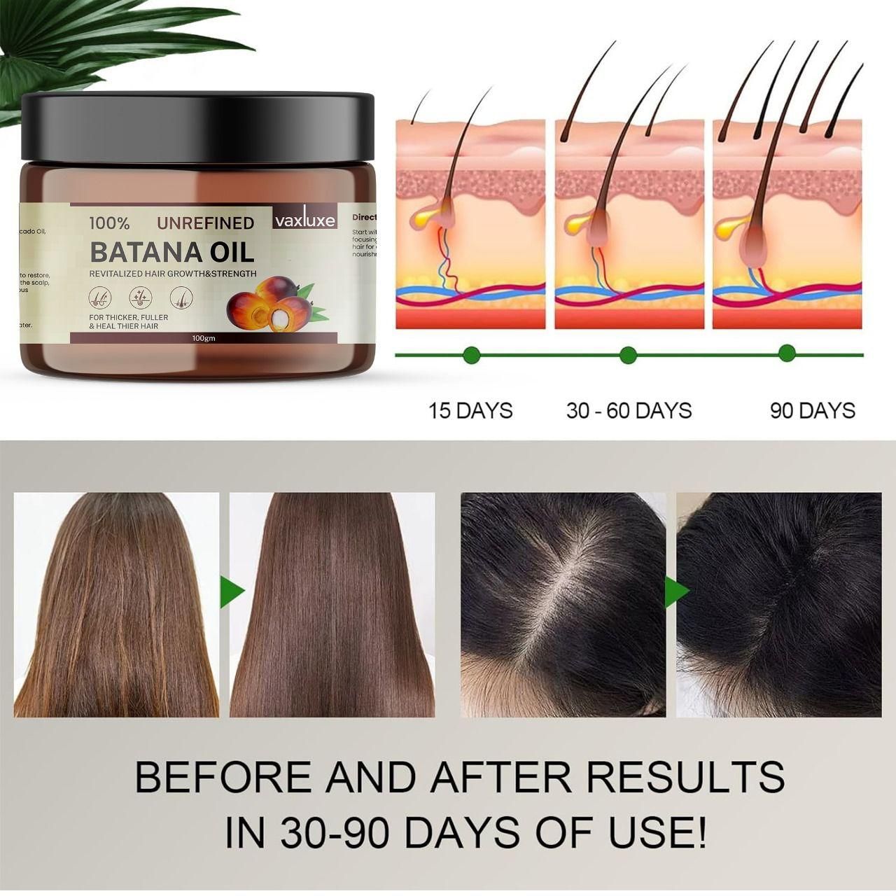 Vaxluxe Batana Oil is a specialized hair treatment formulated to address multiple hair concerns simultaneously. This potent 100g solution works at the follicular level to stimulate dormant hair growth cycles while reinforcing hair structure with essential nutrients. Clinical studies indicate the proprietary blend helps reduce breakage by up to 60% while promoting increased density and improved scalp health. Ideal for those experiencing thinning, damage, or seeking to optimize their hair's natural growth pot