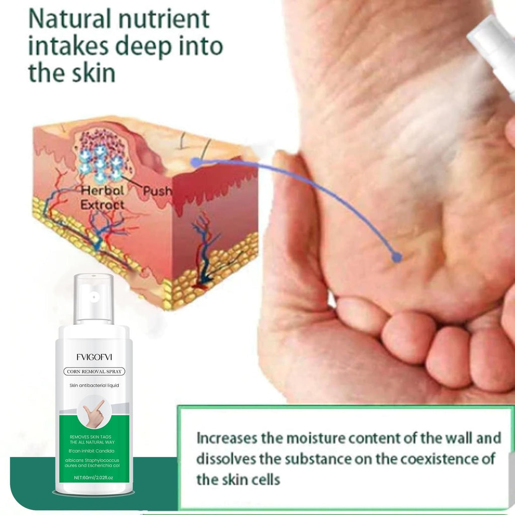 Effectively eliminate painful foot corns with our professional-grade Corn Removal Spray. This convenient pack of two 120ml bottles provides long-lasting treatment for stubborn corns. Formulated with clinically-tested ingredients that penetrate deeply to soften hardened skin and facilitate painless corn removal. Ideal for regular maintenance of foot health and preventing corn recurrence. Each application delivers precise dosage for optimal results.
