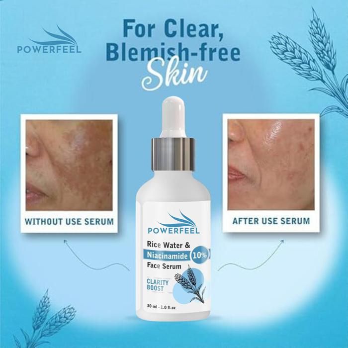 Harness the power of traditional Asian skincare with our Rice Water and 10% Niacinamide Face Serum. This potent 30ML formula combines rice water's brightening properties with niacinamide's proven ability to minimize pores and regulate sebum production. Clinically formulated to reduce hyperpigmentation, strengthen the skin barrier, and improve overall texture for a balanced, radiant complexion.