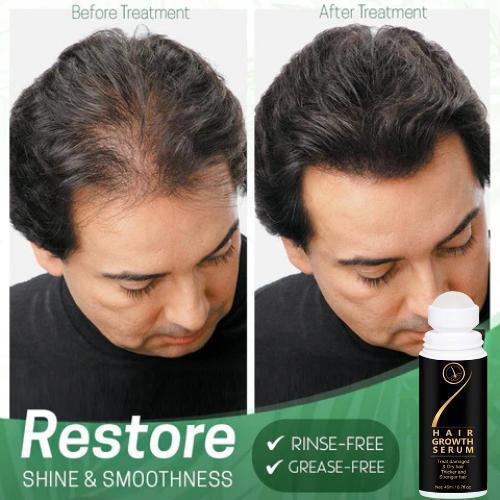 Our Hair Growth SERUM delivers targeted follicular nourishment through a proprietary blend of active compounds. This scientifically-formulated solution penetrates the scalp to revitalize dormant hair follicles, enhance microcirculation, and optimize the growth cycle. The concentrated formula works to strengthen hair structure from root to tip, addressing thinning concerns while promoting visible density and resilience with consistent use.