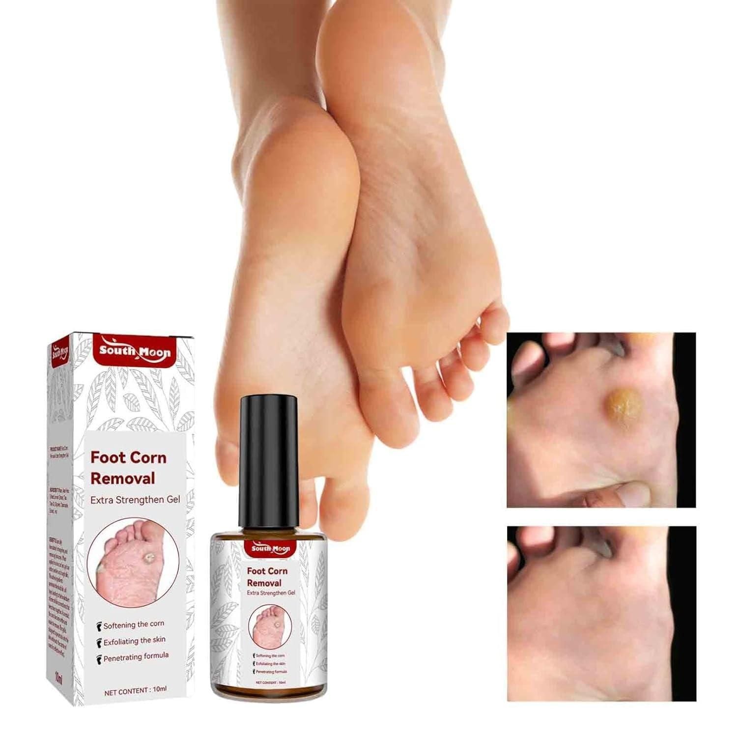 This clinically-formulated Feet Corn Removal Serum (30ml) targets and dissolves painful foot corns with precision. The concentrated solution penetrates hardened skin layers to break down keratin buildup while preserving healthy tissue. Formulated with active ingredients that soften, exfoliate, and repair, this professional-grade treatment offers a non-invasive alternative to surgical corn removal, delivering visible results with consistent application.