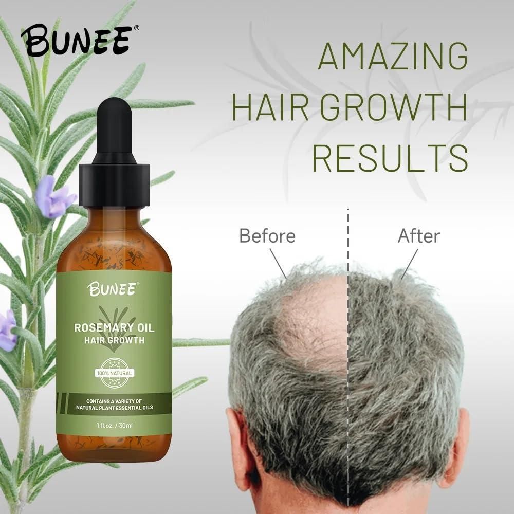 BUNEE Rosemary Hair Growth Serum Oil harnesses the scientifically-backed properties of rosemary to stimulate follicular activity and enhance microcirculation in the scalp. This professional-grade 30 ML formulation delivers targeted nutrients to hair roots, addressing thinning concerns while strengthening the hair shaft structure. Available in dual or triple packs for optimal treatment continuity and sustained results over time.